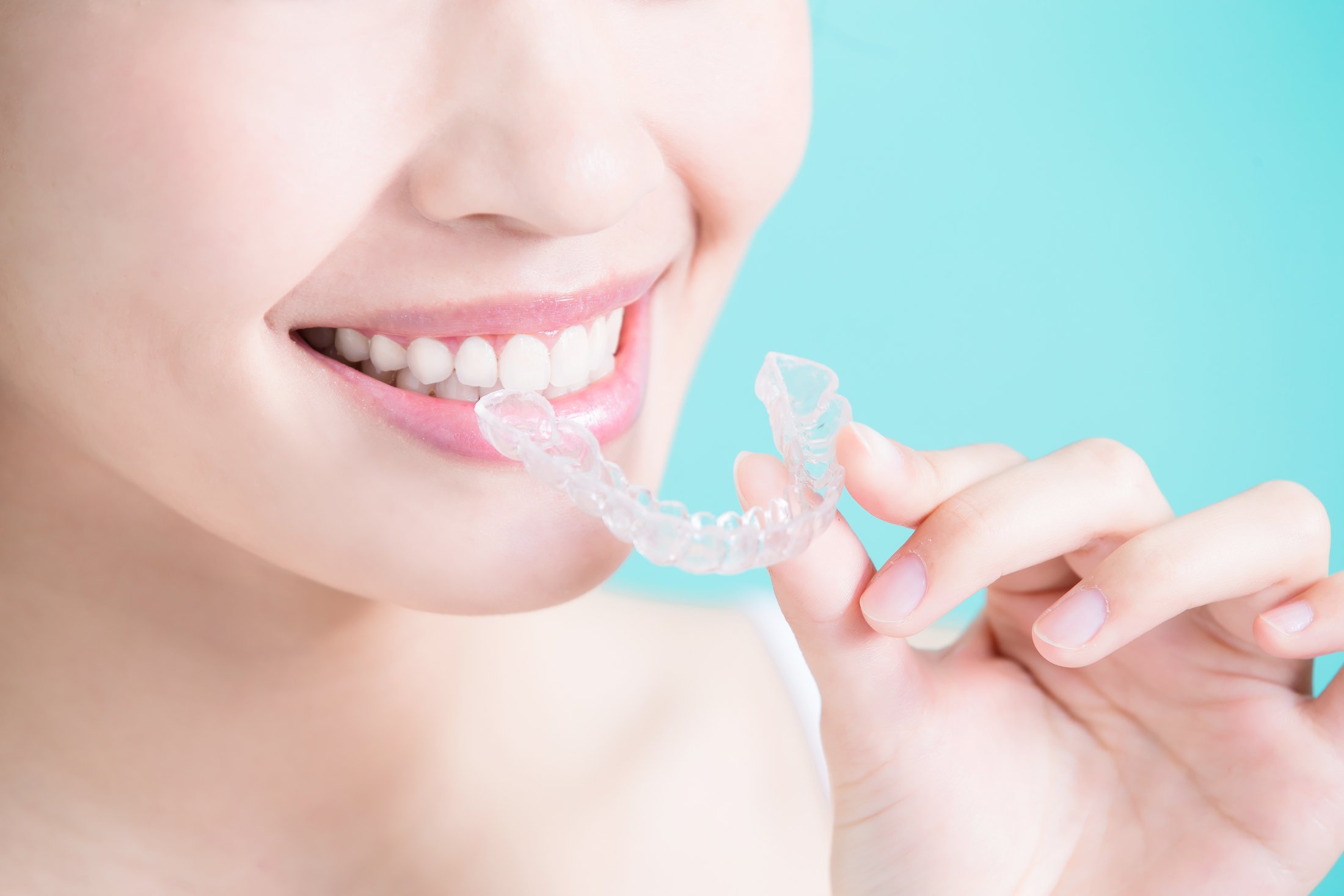 Woman putting in her clear aligners