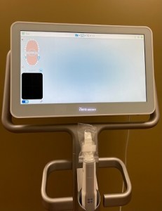 Itero Scanner
