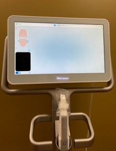 Itero Scanner
